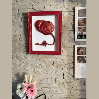 Babybauch-Gipsabdrücke in Magdeburg, Sachsen-Anhalt - Kundenfoto